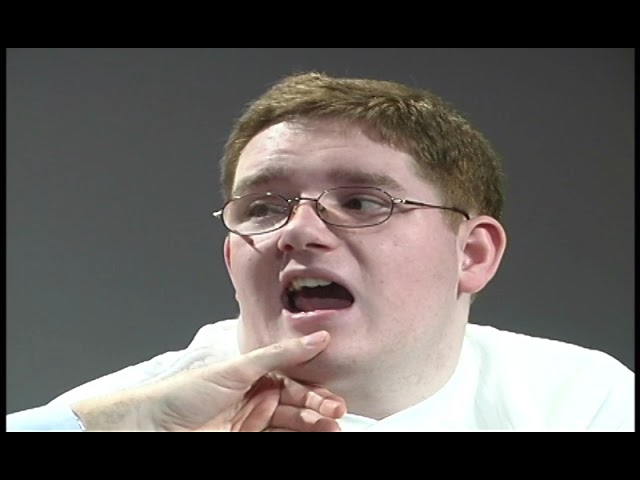 Cranial Nerve Exam: Pseudobulbar Palsy