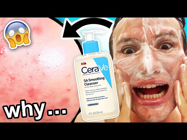 I tried CeraVe SA Cleanser for ONE WEEK!! (I was shocked honey... in tears almost)