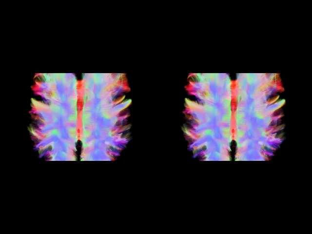 Fire and Wire - The brain in 3D