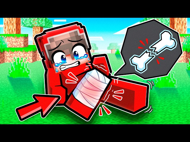 I BROKE My LEG in Minecraft!