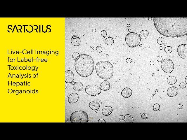 Live-Cell Imaging for Label-free Toxicology Analysis of Hepatic Organoids