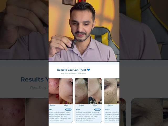 How to Add a Mystery Discount Popup to Shopify Store | Shopify CRO Custom Code