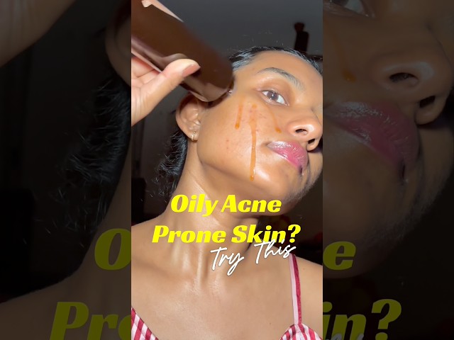Try this #skincare #greenteatoner #tonerforoilyskin #acneproneskin