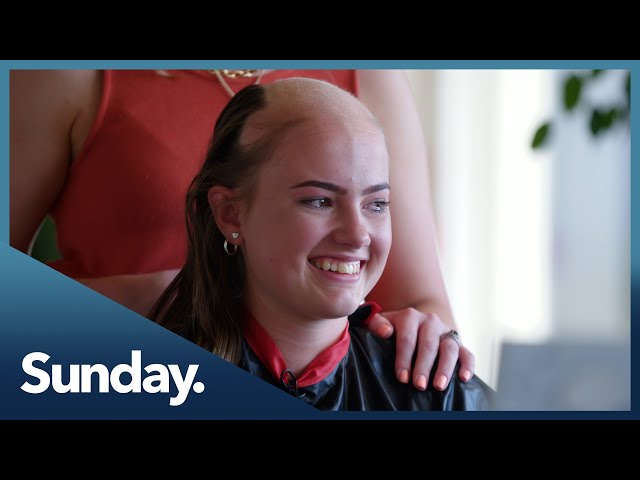Living with alopecia: Four women share their journeys