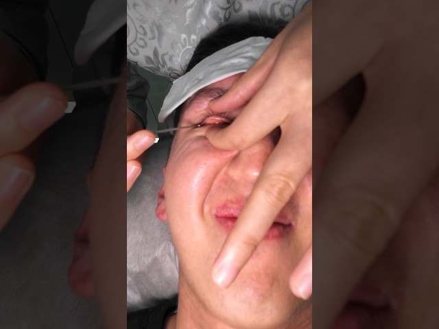 Trying China’s Craziest Eyeball Massage 🇨🇳