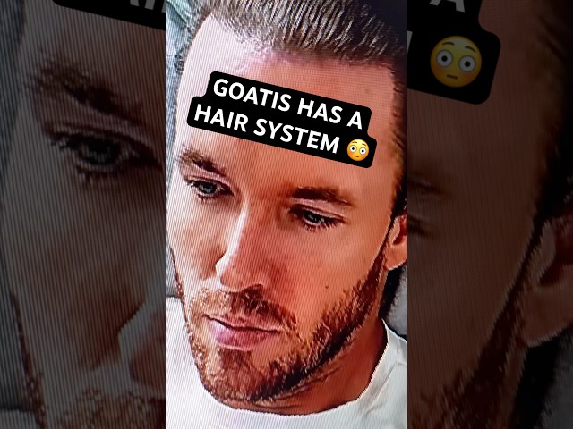 Goatis Secretly Glues a Wig to his head