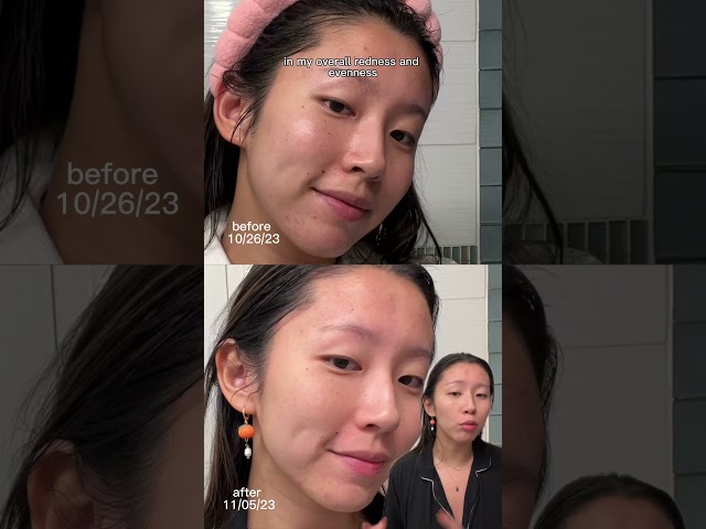 Proactiv Clean Results!