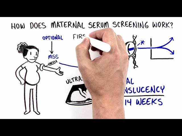 Maternal Serum Screening (MSS)