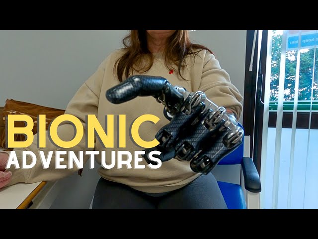YOU Ride a Motorcycle with a Bionic Arm? WTF | MOTO LIFE