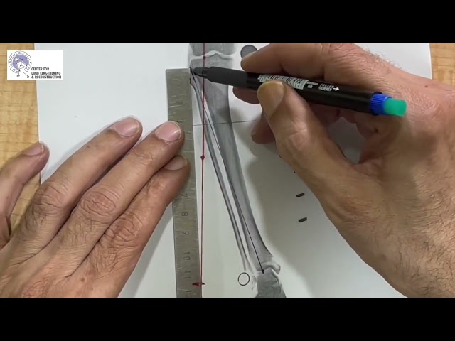 HTO planning video