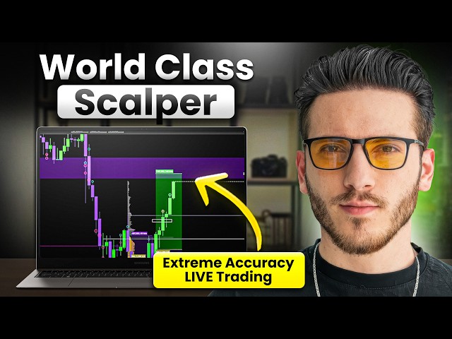 Trading LIVE with One of the World's BEST Scalpers (PERFECT Sniper Entries)