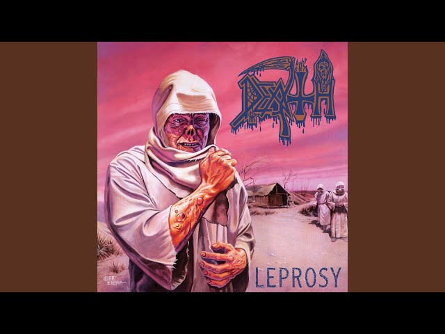 Leprosy