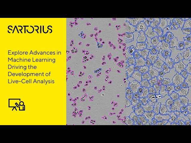 Conference Presentation: Quantifying Morphological Change Using Label-Free Live-Cell Analysis