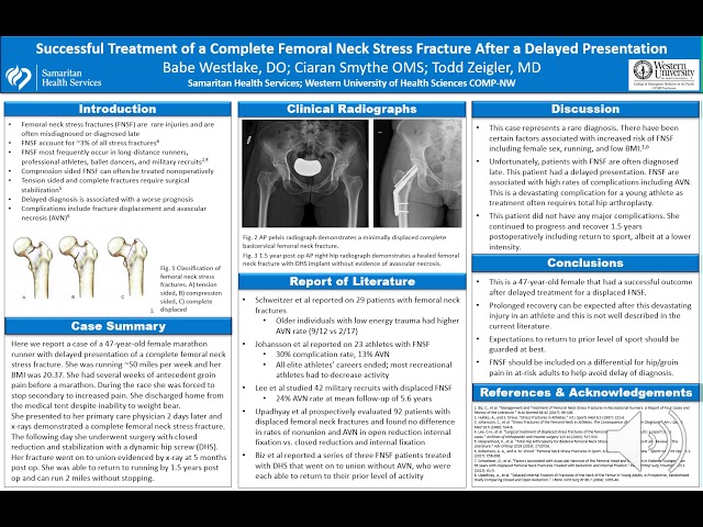 Successful Treatment of a Complete Femoral Neck Stress Fracture After a Delayed Presentation