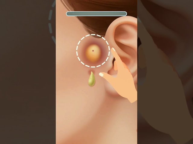 ear treatment 😮💥 #shorts #asmr #treatment #games #viral