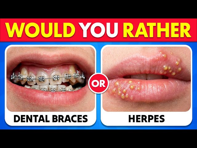 🔥 Would You Rather...? 😨 The 100 Most Extreme Choices You’ll EVER Face!