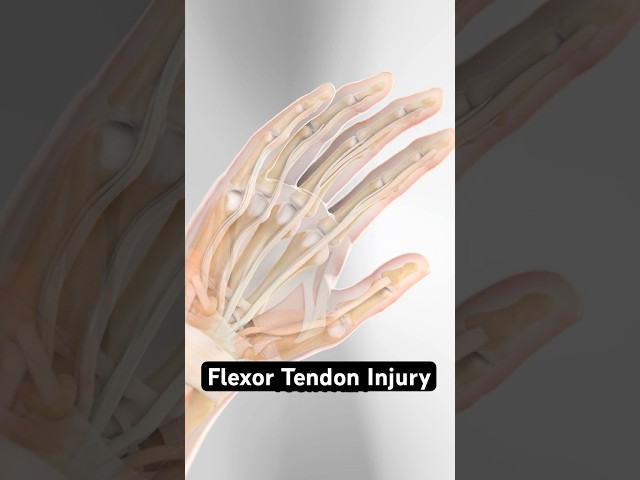 Can’t Bend Your Finger? This Might Be Why