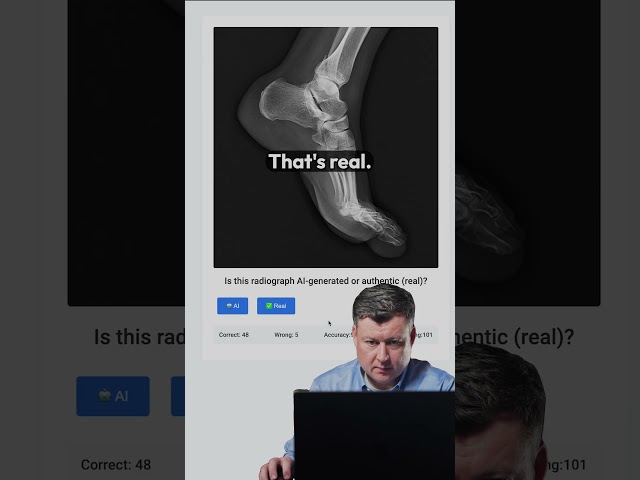 STAT reporter tries to beat real radiologists on deepfake quiz