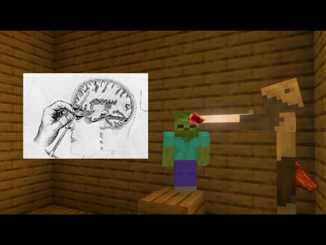 Minecraft but I’m getting a lobotomy 