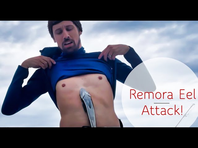 Remora Eel Attack!