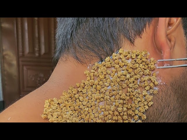 Satisfying Seed Peel ASMR : Using Tweezers (Spinach Seeds) (Par-3)