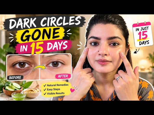 Dark Circles Removal in 15 Days | Simple Home Remedy and Tips