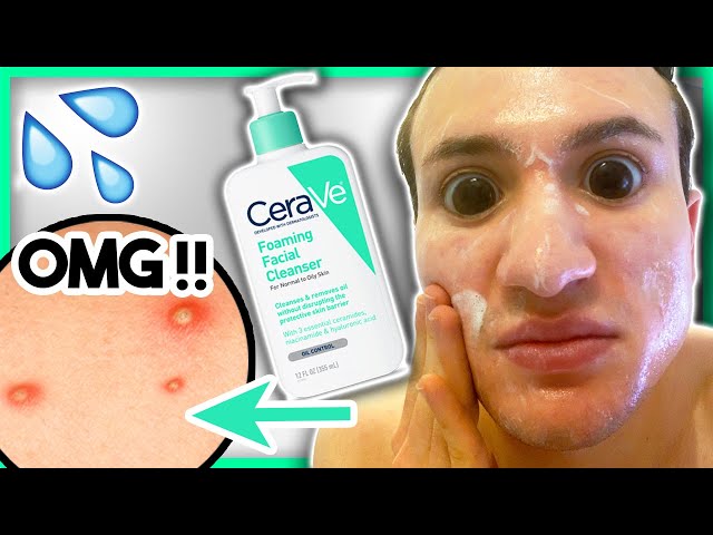 I used CeraVe Foaming Facial Cleanser for ONE WEEK!! (it broke me out?!)