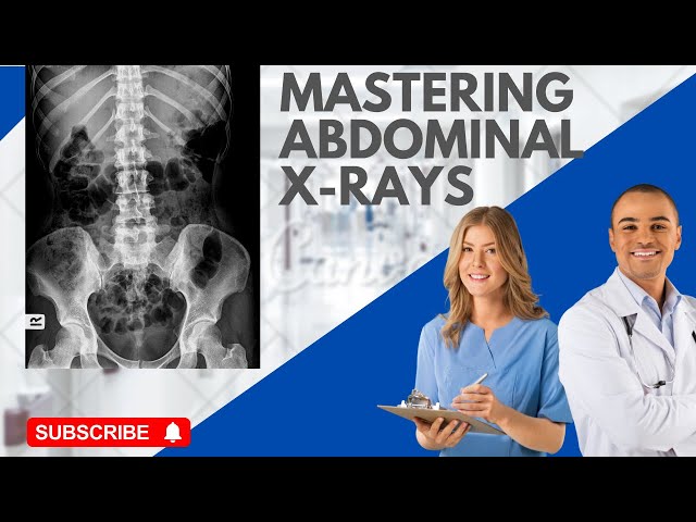 How to Interpret Abdominal X-Rays | Acute Findings Made Easy
