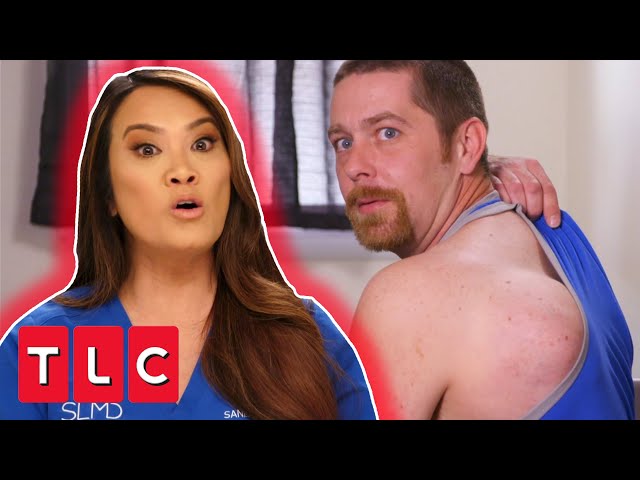 Bowling Ball Lipoma Removed From Mans Back! | Dr Pimple Popper: This Is Zit
