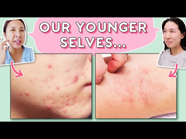 Teens & 20s: Skincare Habits We WISH Someone Told Us Earlier! 😇