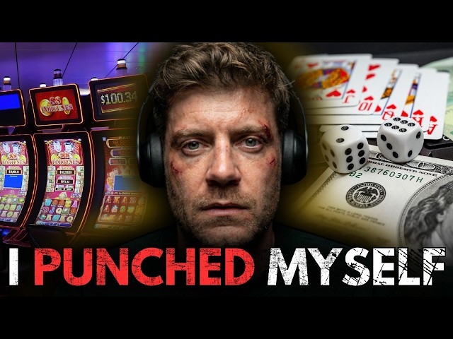 I Couldn't Stop Gambling... So I Started Hitting Myself | Aarons Journey To Recovery