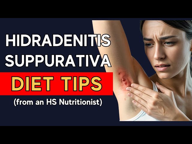 Hidradenitis Suppurativa Diet Remedies (From A Clinical Nutritionist Who Had HS)