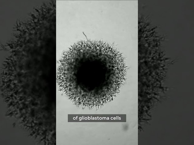 The Science Behind Tumor Progression