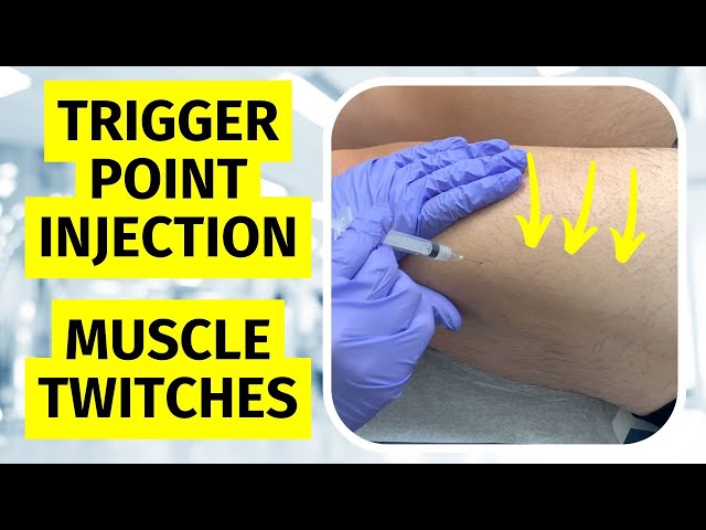 Trigger Point Injection Twitches / Dry Needling Twitch Response