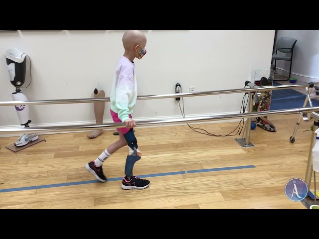 Emely, first steps with rotationplasty prosthesis
