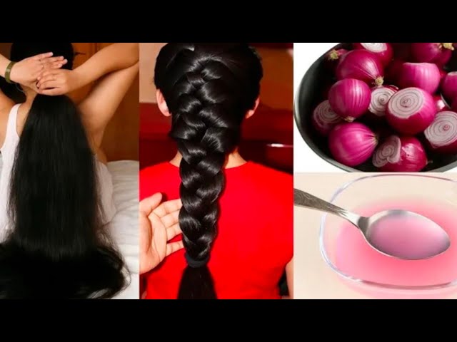 Homemade Onion Hair Growth Serum for Long Thick Hair/Fast Hair Growth Serum 