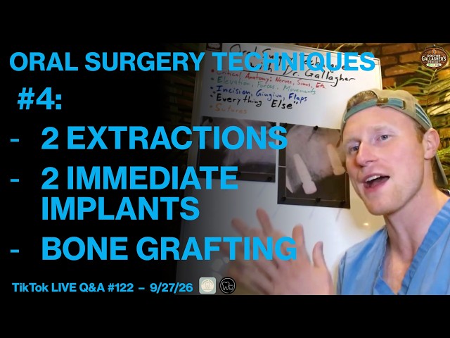 2 Extractions, 2 Immediate Implants, Bone Grafting | Oral Surgery Techniques #4 with Dr. Gallagher