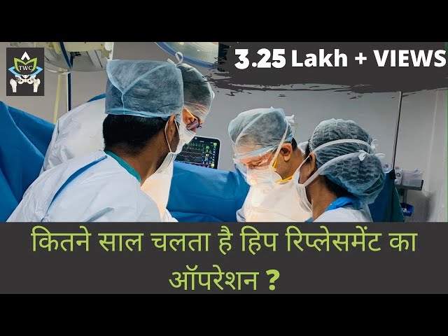 कितना चलता हैHip Replacement और THR पर अक्सर पूछे जाने वाले कई सवालों के जवाब?Can THR last 30 years?
