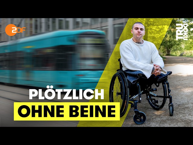 Alex (31) hat einen Straßenbahnunfall überlebt: “Ich dachte, ich sterbe” | TRU DOKU