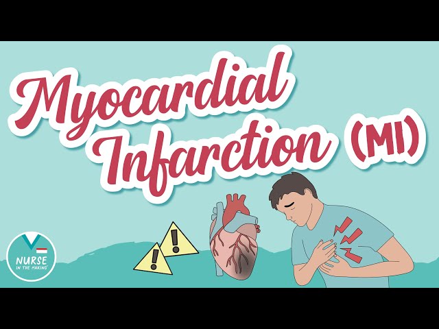 Myocardial Infarction (MI) Overview  | Med-Surg | Nursing School | Pathology | Signs & Symptoms
