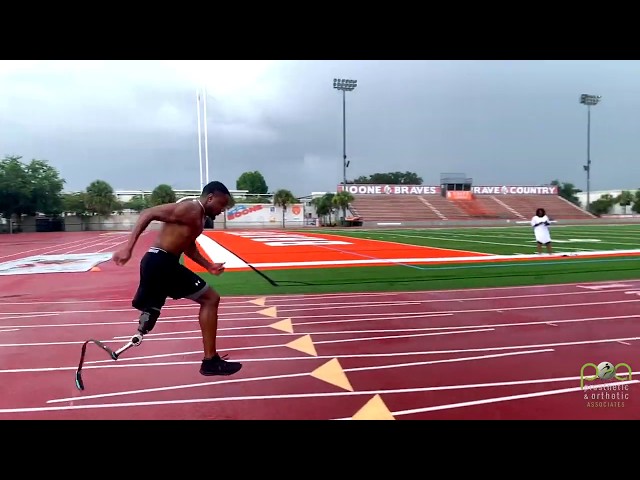 Amputee Running on Patterson Propulsion Socket PPS Prosthetic Leg