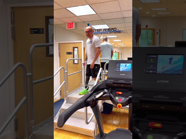 Jonattan, Below-Knee Amputee, Walking with a Prosthetic Leg