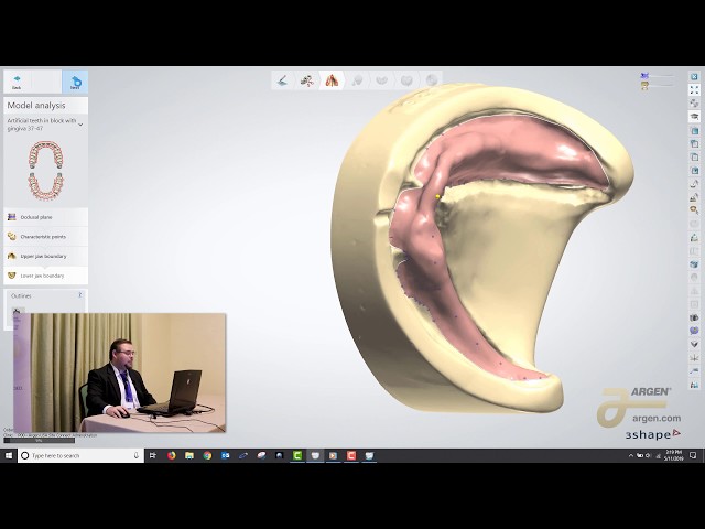 Digital Dentures: A Crash Course on How to Design using 3Shape - Logan Woomer