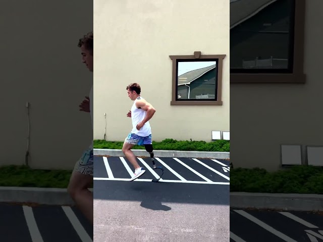 Above-Knee High-Activity Prosthesis with Running Blade | Louis
