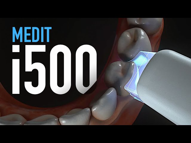 The Medit i500 Intraoral Scanner for Dental Clinics