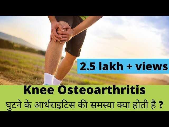 knee osteoarthritis(घुटने के आर्थ्राइटिस) explained in Hindi by Dr. Pankaj Walecha.