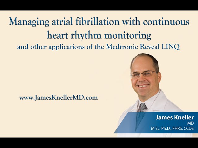Management of atrial fibrillation guided by the Medtronic Reveal LINQ.