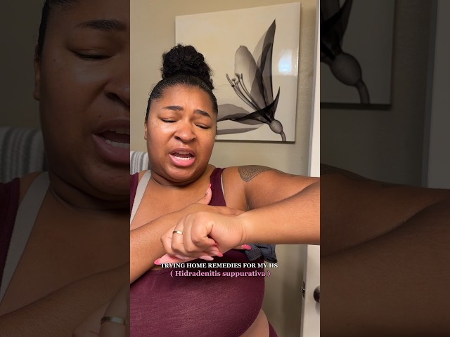 BAD HS (Hidradenitis Suppurativa) FLARE UP! Trying lime for deodorant. #hs #cyst