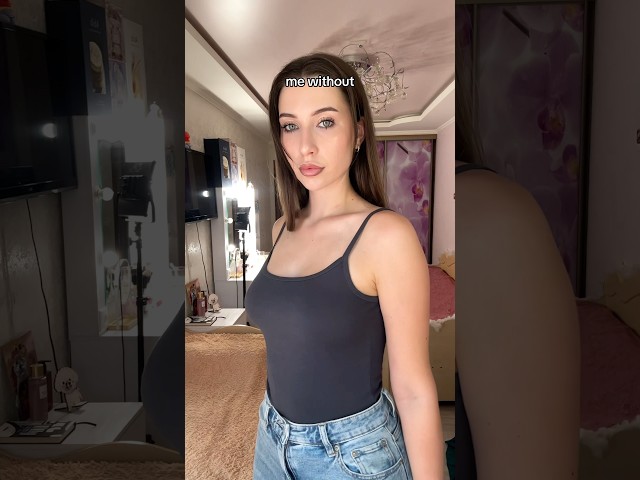 My best decision ever, getting breast reduction surgery 🥹#breastreduction