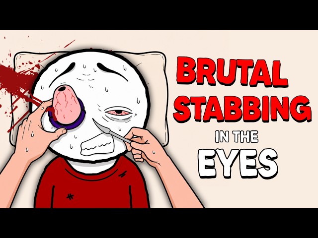 Ancient Medical Practices That Were Completely INSANE